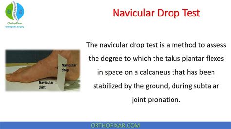 define experience when discussing navicular drop test|how to palpate the navicular.